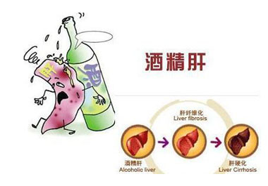 得了酒精肝怎么辦 補硒是關鍵