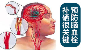 預防腦血栓 補硒很關鍵