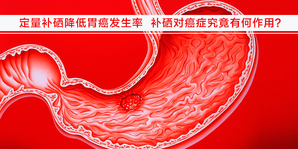 遠(yuǎn)離胃癌不難，改變不良習(xí)慣外多補硒