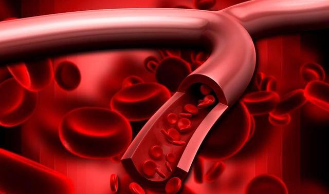 老人血脂稠危害大，多補(bǔ)硒有助降血脂