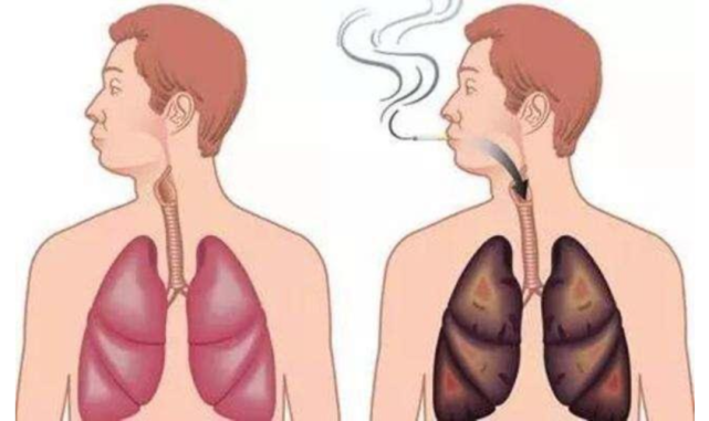 補硒，給你的肺部洗洗澡吧